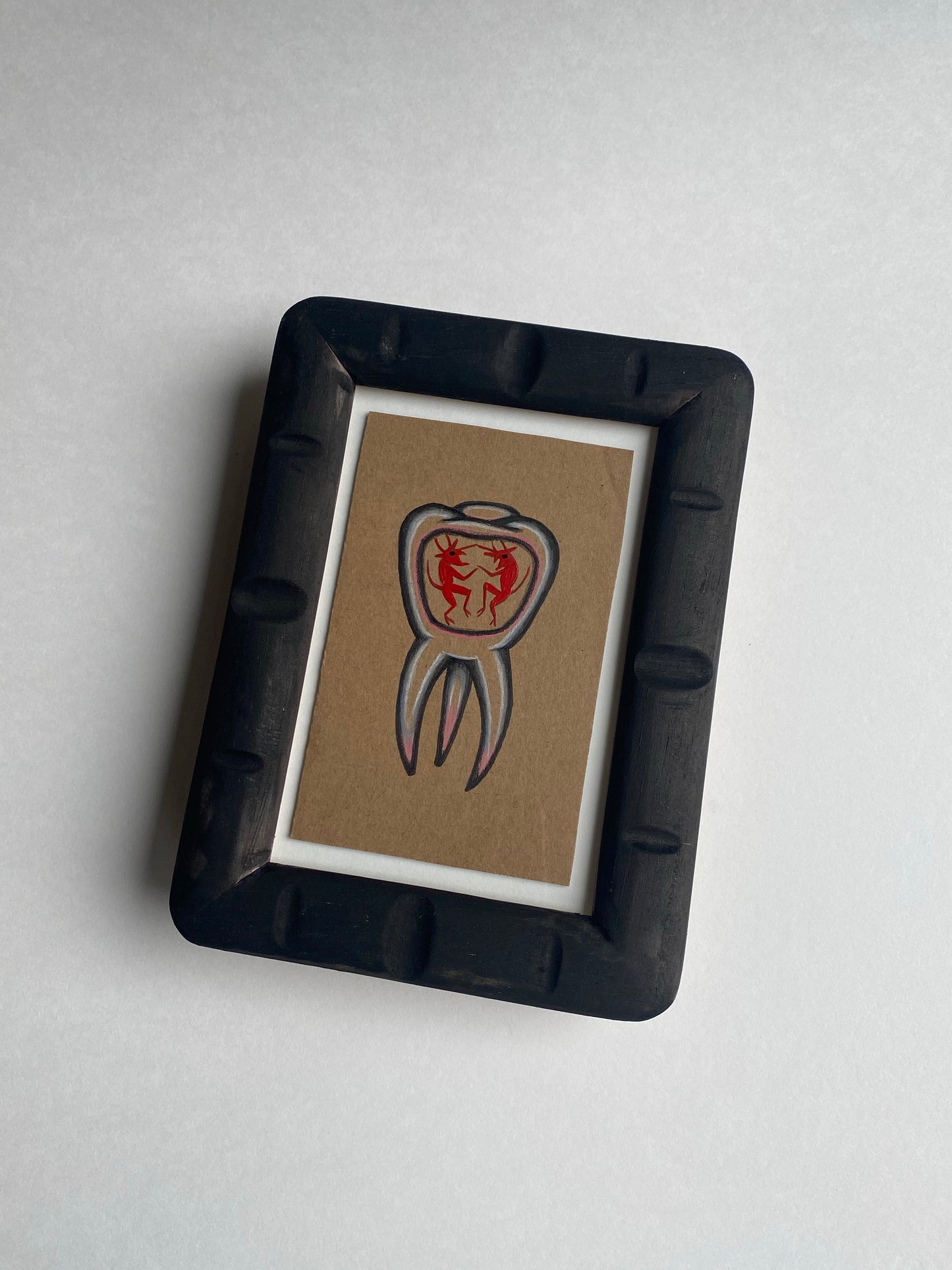 Toothache - Framed Original